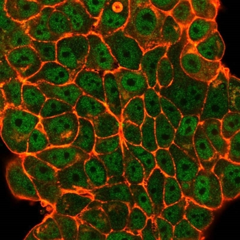 ELK1 Antibody