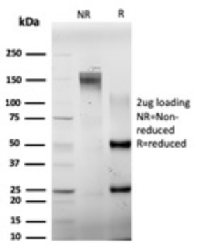 ELK1 Antibody