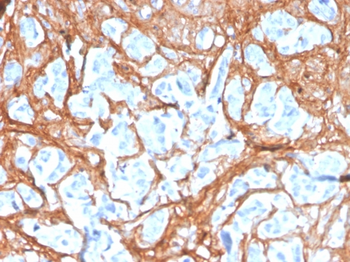 POSTN Antibody