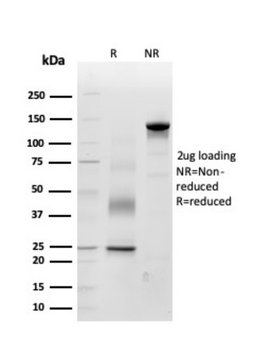 POSTN Antibody