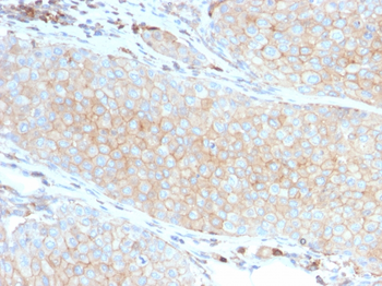 CD274 Antibody (Biotin)