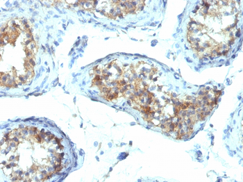 Interferon gamma (IFNG) Antibody