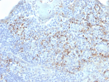 HAVCR2 Antibody