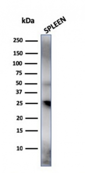 HAVCR2 Antibody