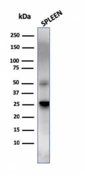 HAVCR2 Antibody