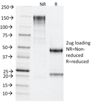 TDP2 Antibody