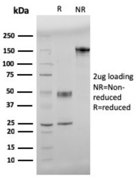 APP Antibody