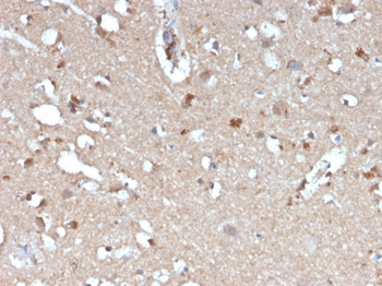 APP Antibody