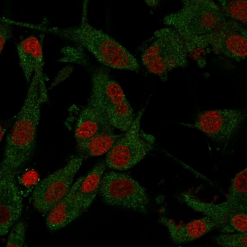 APP Antibody