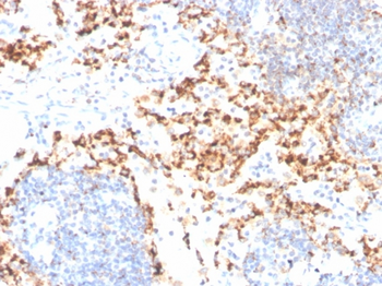HAVCR2 Antibody