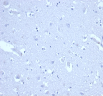 CDKN1A Antibody