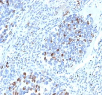 CDKN1A Antibody