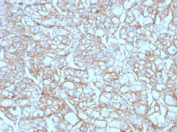 CD274 Antibody