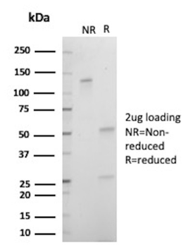 Recombinant Double Stranded DNA (dsDNA) (Nuclear Marker) Antibody