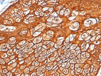 KRT77 Antibody