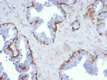 KRT5 Antibody