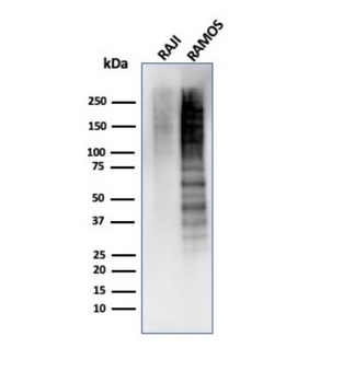 MKI67 Antibody
