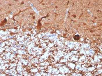 UCHL1 Antibody