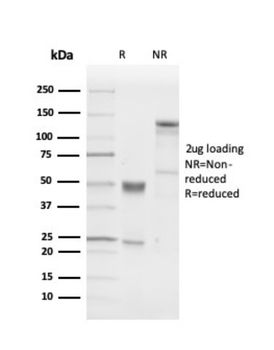 UCHL1 Antibody