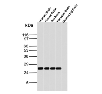 UCHL1 Antibody