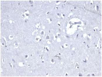 CDH1 Antibody