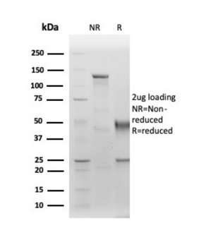 ALB Antibody
