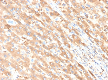 ALB Antibody
