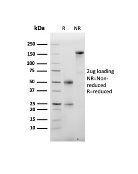 ALB Antibody