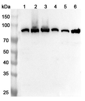 MMUT Rabbit Polyclonal Antibody