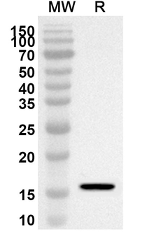 IL21 Rabbit Polyclonal Antibody
