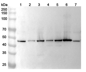 GALNS Rabbit Polyclonal Antibody