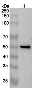 D2HGDH Rabbit Polyclonal Antibody