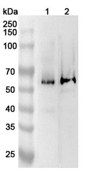 IFNAR2 Rabbit Polyclonal Antibody