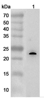 ESM1 Rabbit Polyclonal Antibody