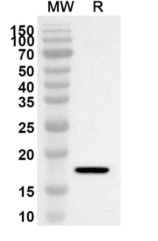 TPT1 Rabbit Polyclonal Antibody