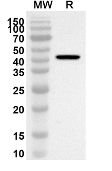 NEDD4L/Nedd4-2 Rabbit Polyclonal Antibody