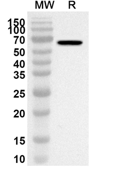 MAOA Rabbit Polyclonal Antibody