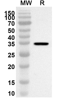 RPLP2 Rabbit Polyclonal Antibody