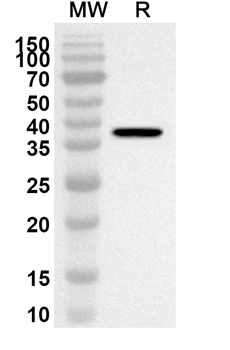 ZNRD2 Rabbit Polyclonal Antibody