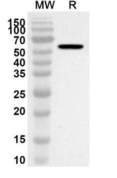 Evolocumab Rabbit Polyclonal Antibody