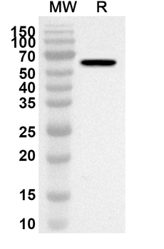 P4HA1 Rabbit Polyclonal Antibody