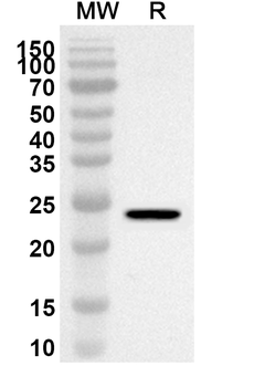 VSIG2 Rabbit Polyclonal Antibody