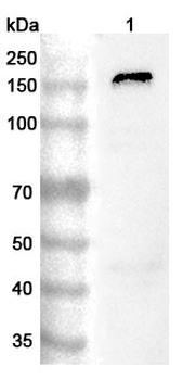 PTK7/CCK-4 Rabbit Polyclonal Antibody