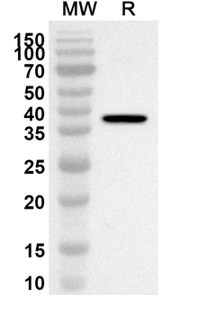 GAS1 Rabbit Polyclonal Antibody
