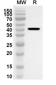 SFTPD Rabbit Polyclonal Antibody