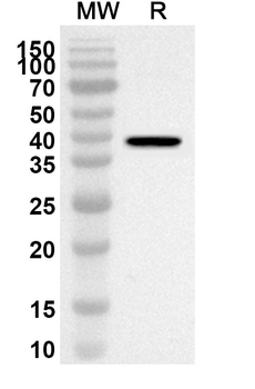 NINJ1 Rabbit Polyclonal Antibody