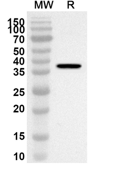 CER1 Rabbit Polyclonal Antibody