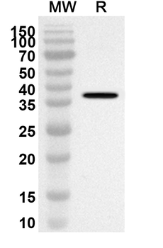 DSG2 Rabbit Polyclonal Antibody