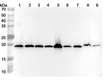 RPL24 Rabbit Polyclonal Antibody