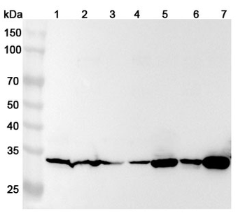 TPM4 Rabbit Polyclonal Antibody